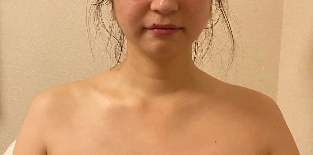 施術後